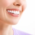 Understanding the Ideal Frequency for Teeth Cleaning