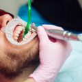 Recognizing the Need for Professional Teeth Cleaning: Key Signs to Watch For