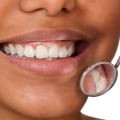 The Impact of Diet on the Frequency of Professional Teeth Cleanings
