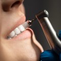 Understanding the Pain of Teeth Cleaning: What to Expect