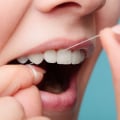Flossing and Teeth Cleaning: What You Need to Know