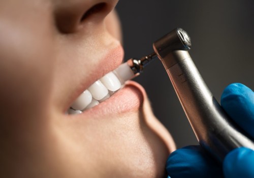 The Essential Benefits of Regular Teeth Cleaning for Optimal Oral Health