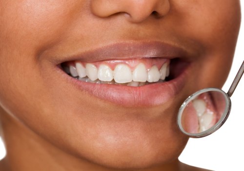 The Impact of Diet on the Frequency of Professional Teeth Cleanings