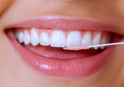 Teeth Cleaning and Its Impact on Daily Oral Hygiene